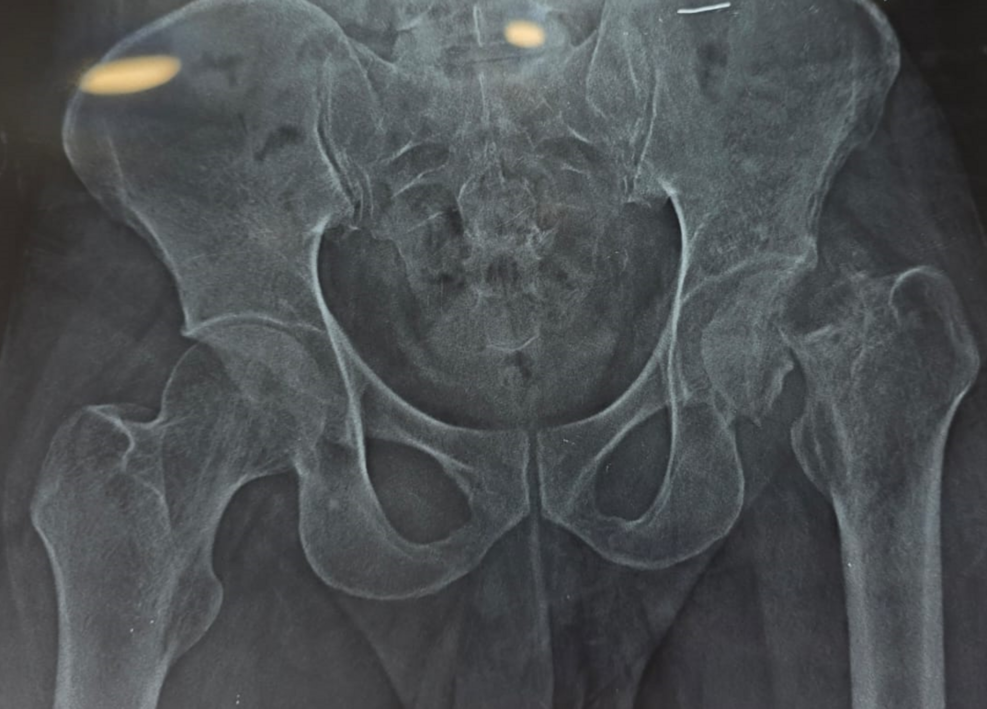 The Orthopod - Bone and Joint Clinic|Toli Chowki,Hyderabad