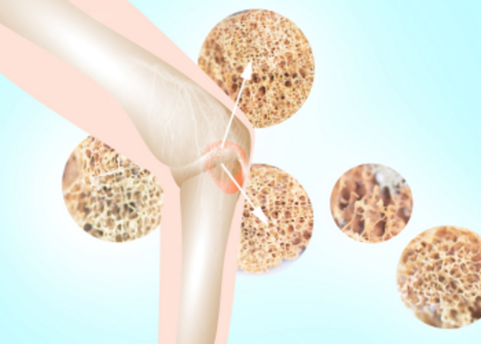 Bone Tumor Management